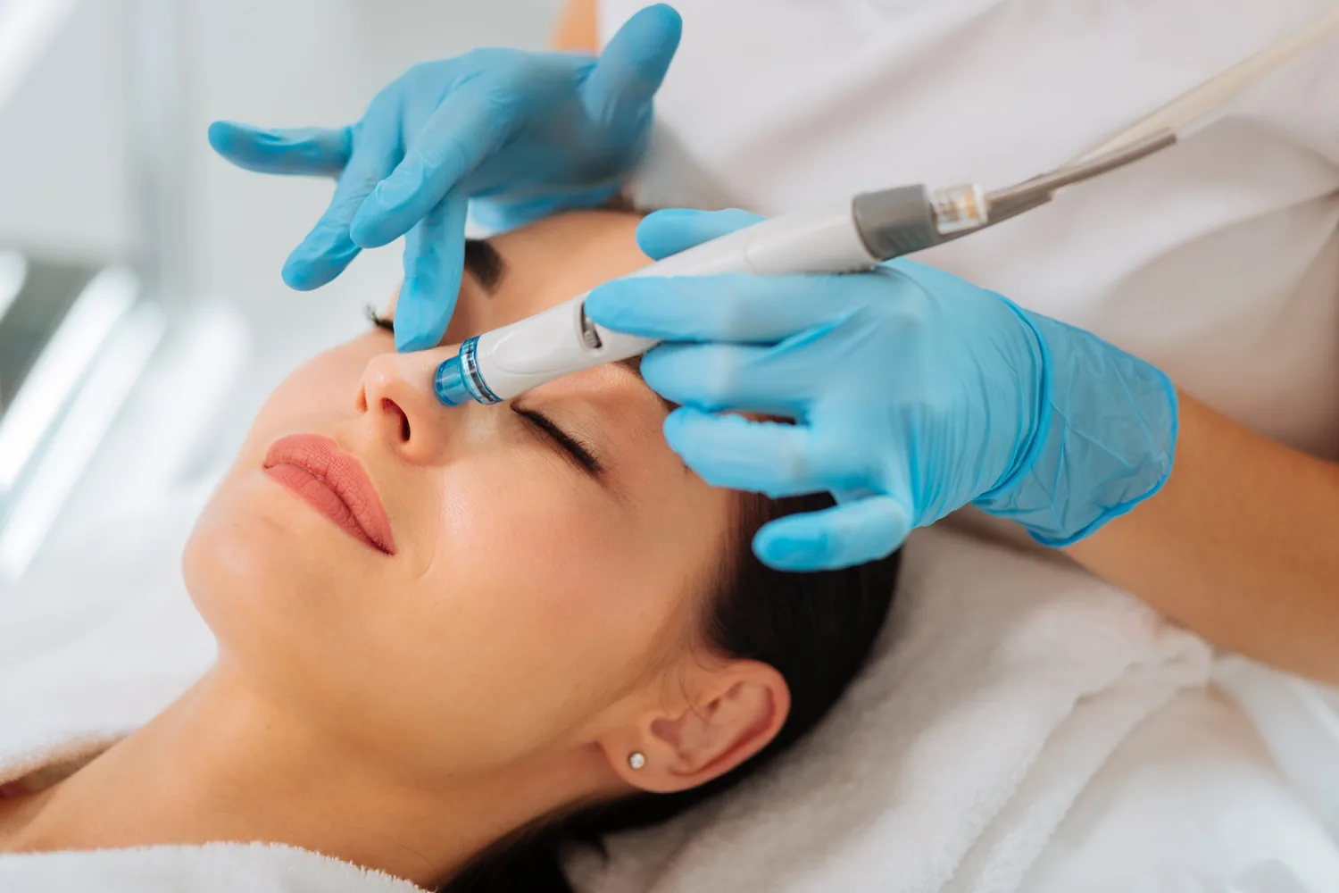 Woman receiving a dermabrasion treatment on her face