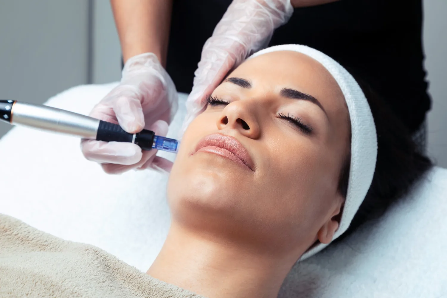 medical dermatology woman patient-undergoing-microneedling-dermatologist