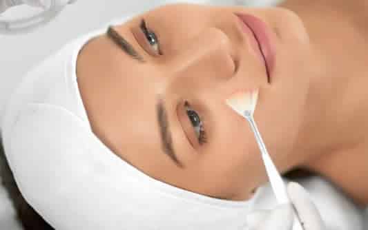 The Benefits of Chemical Peels for Healthy Skin