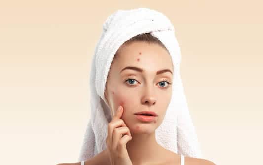 3 Biggest Skincare Mistakes that Aggravate & Perpetuate Adult Acne
