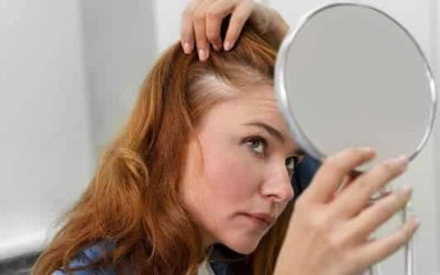 Female Hair Loss: What Causes It and How to Stop It