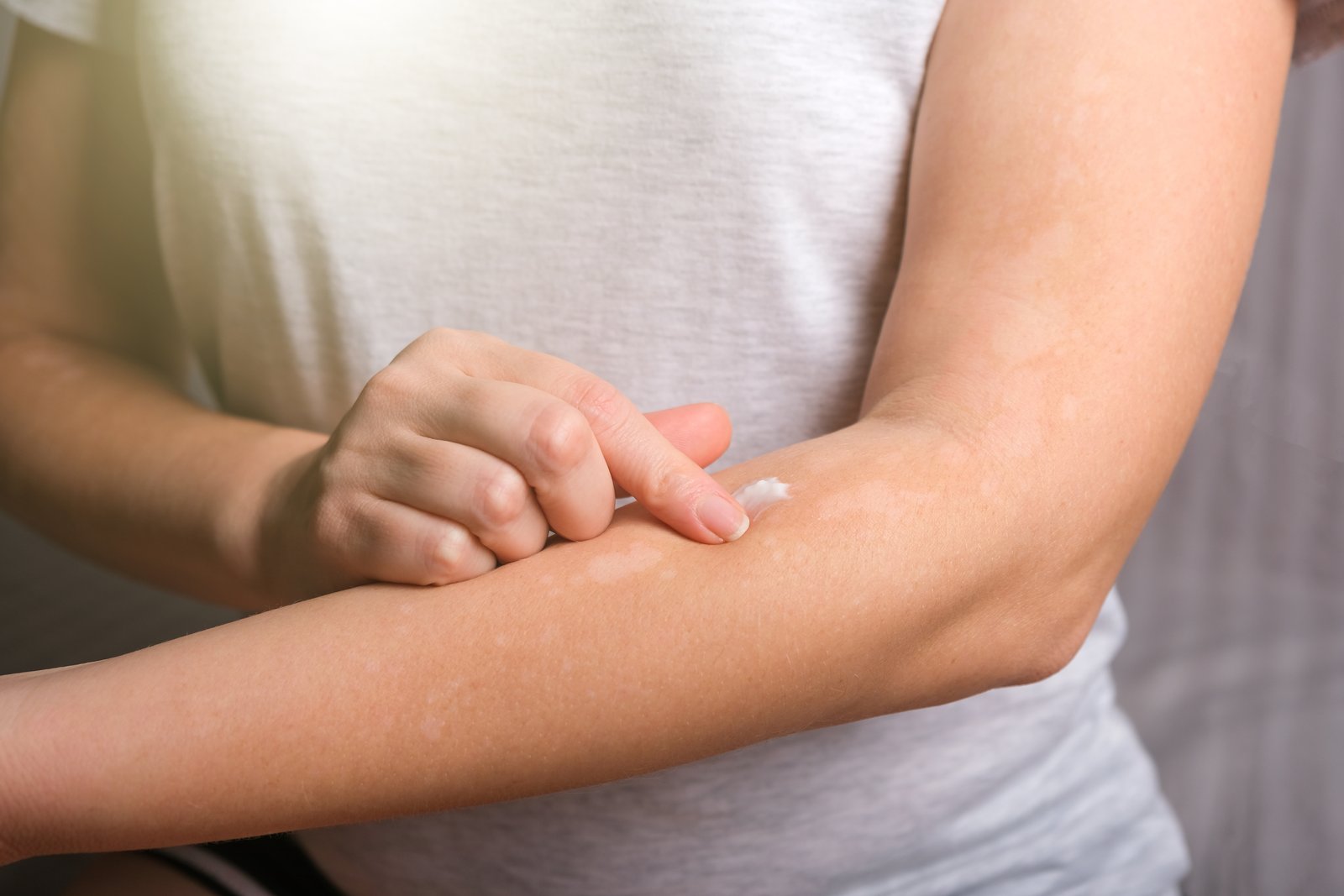 Person touching a reddened patch of skin on their forearm