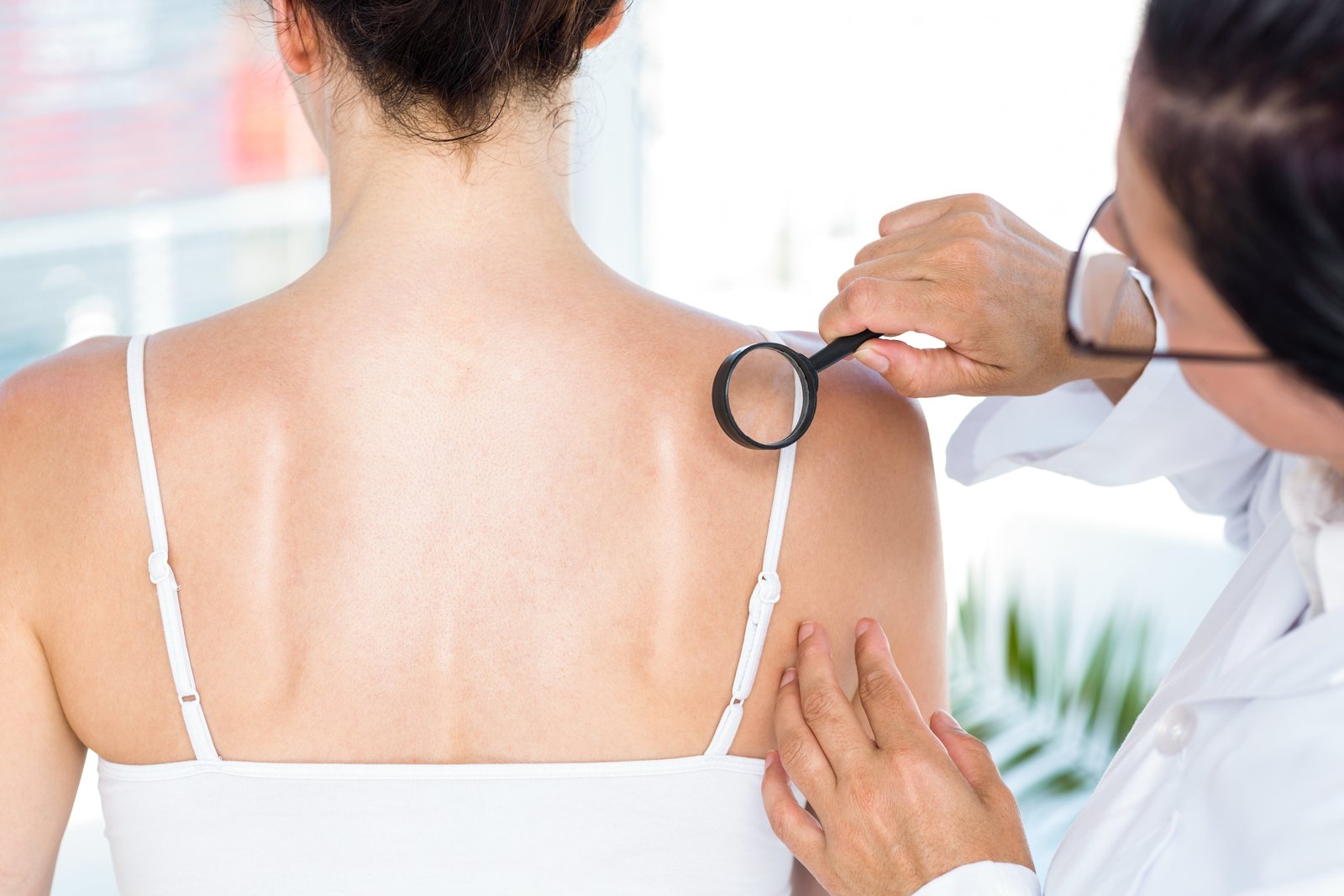 Dermatologist holding a magnifier to a patient's shoulder during a skin check