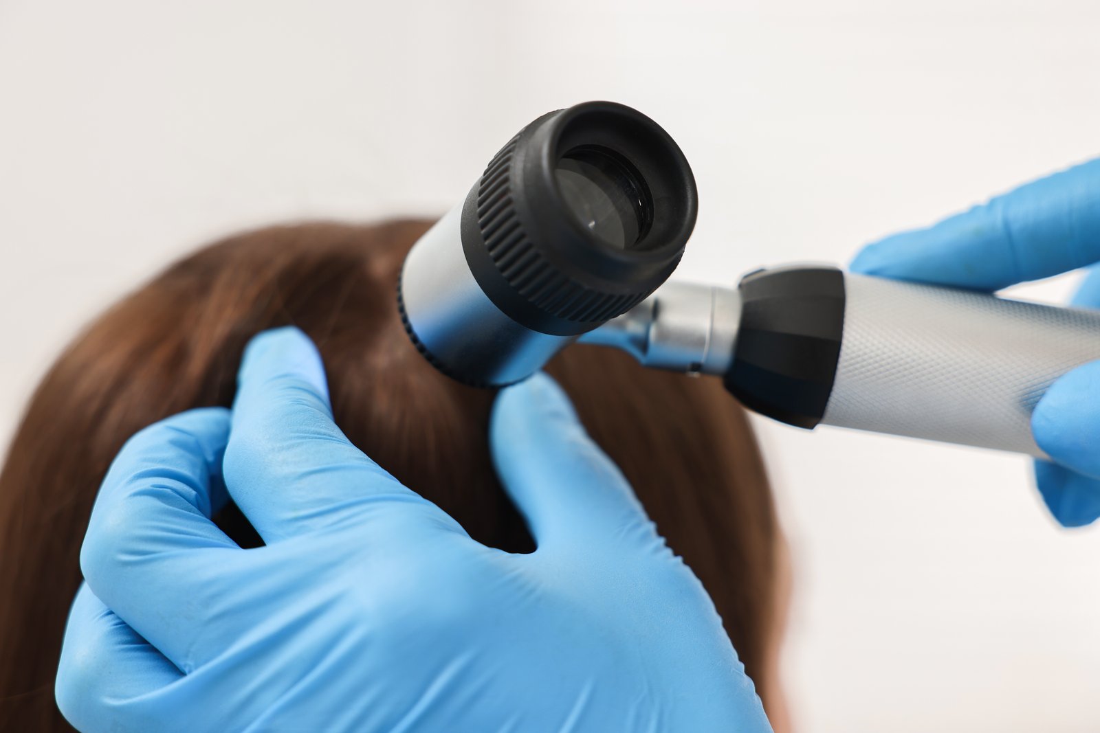Gloved hands parting a patient's hair and examining the scalp with a dermatoscope