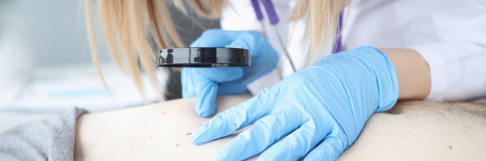 Gloved hands examining an area of skin on a patient's arm