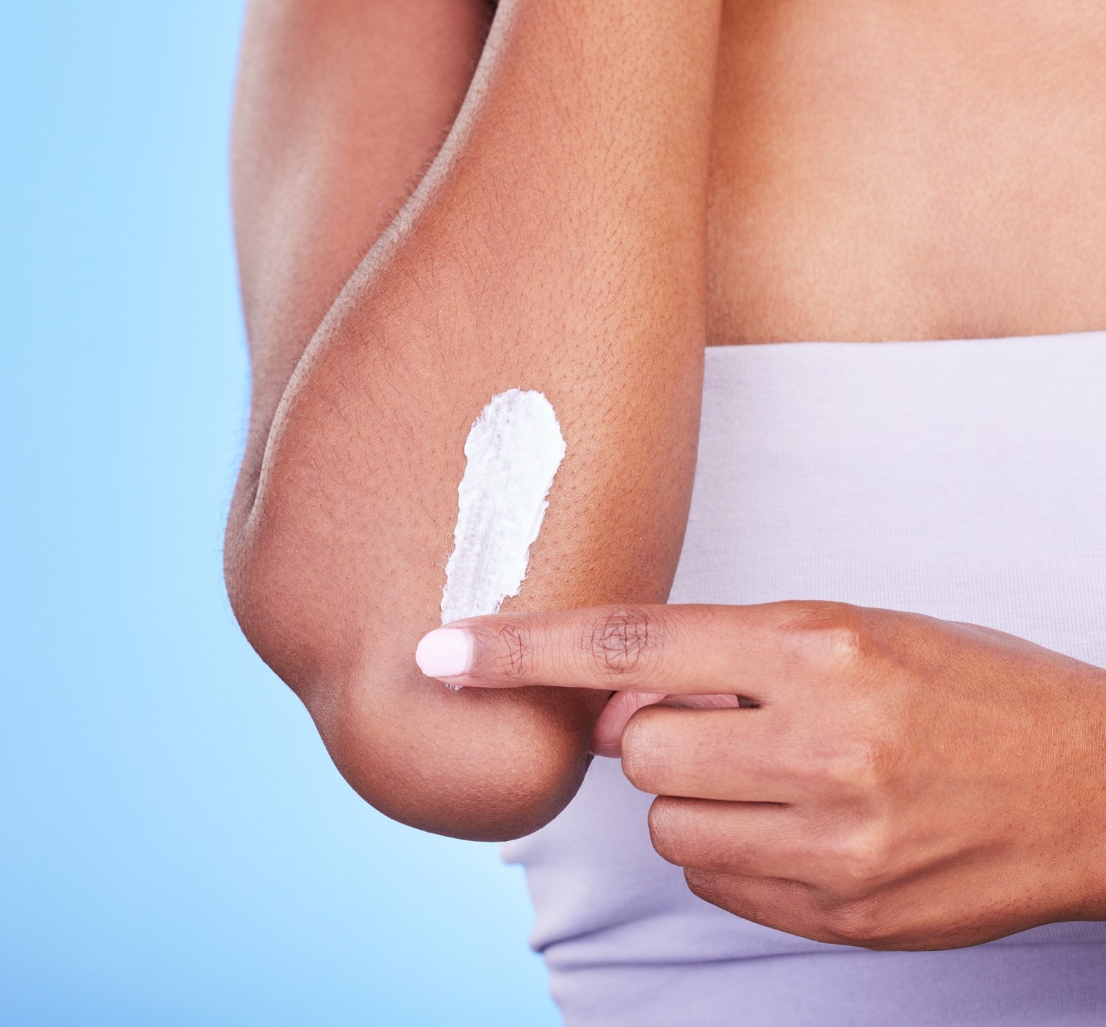 Finger spreading a dab of cream over a dry elbow