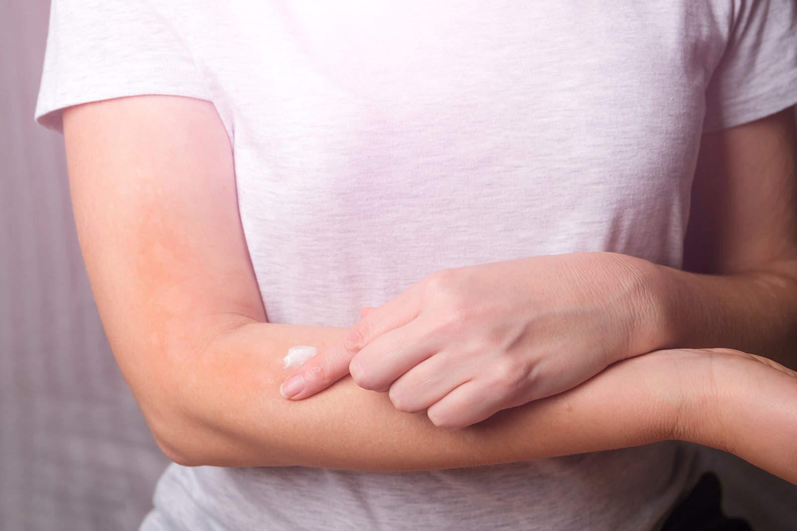 Person applying moisturiser to their forearm