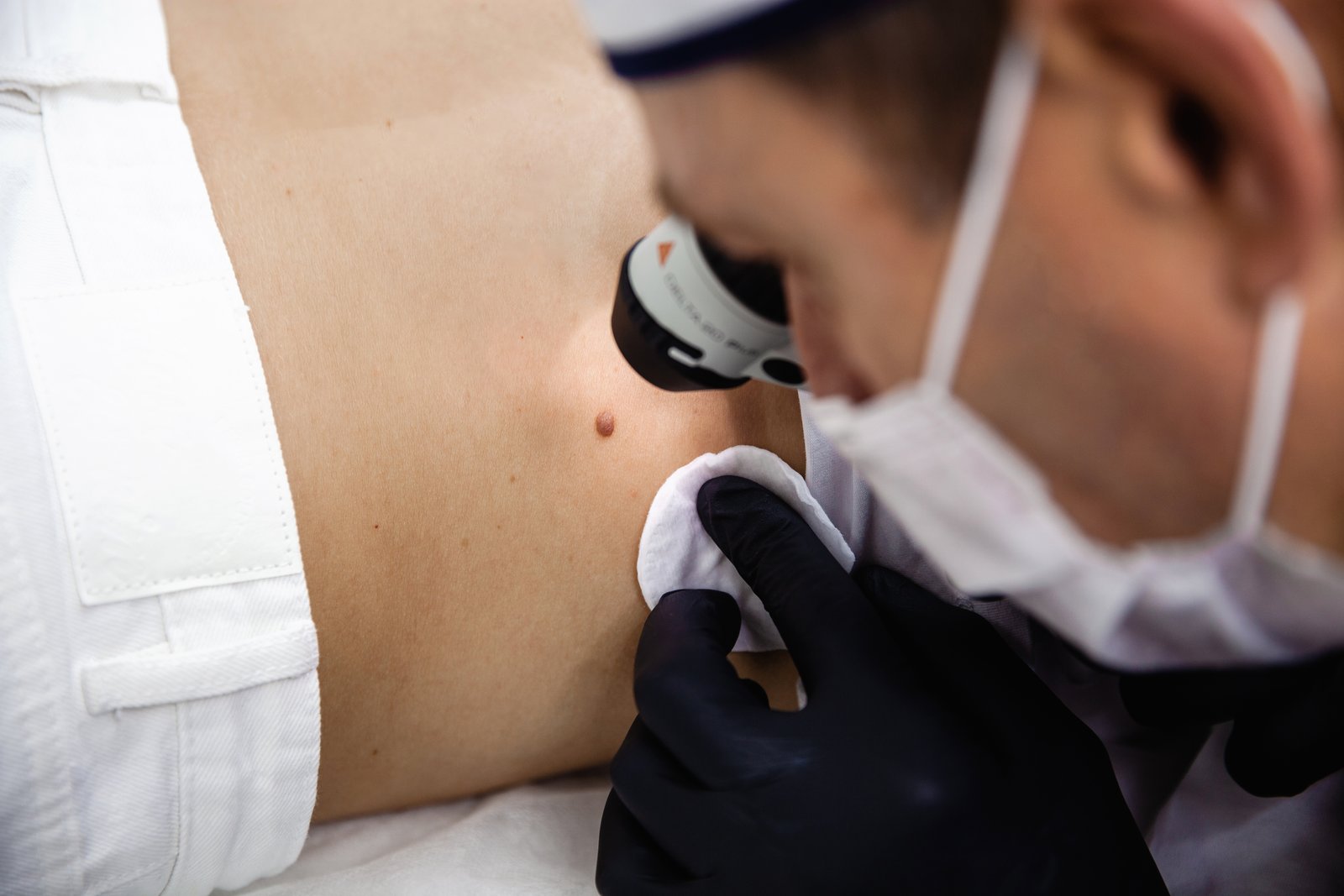 Masked dermatologist examining skin on a patient's torso with a dermatoscope