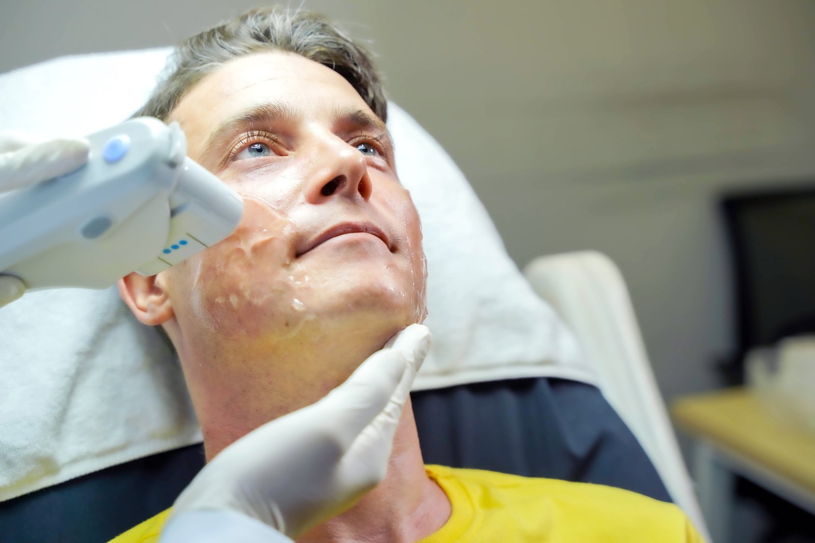 Man reclining in a clinic chair during a facial skin treatment