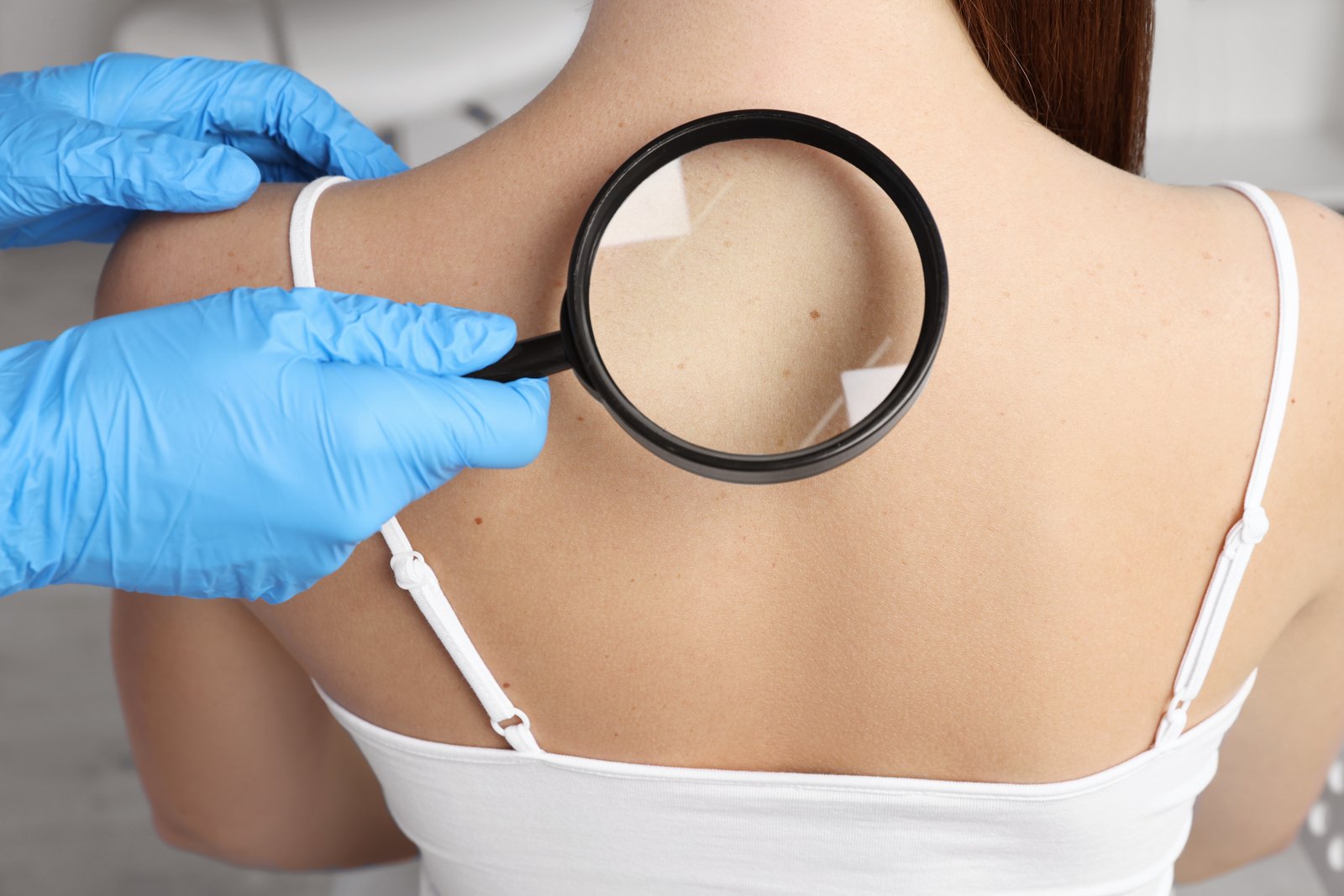 Gloved hands holding a magnifier against a patient's upper back