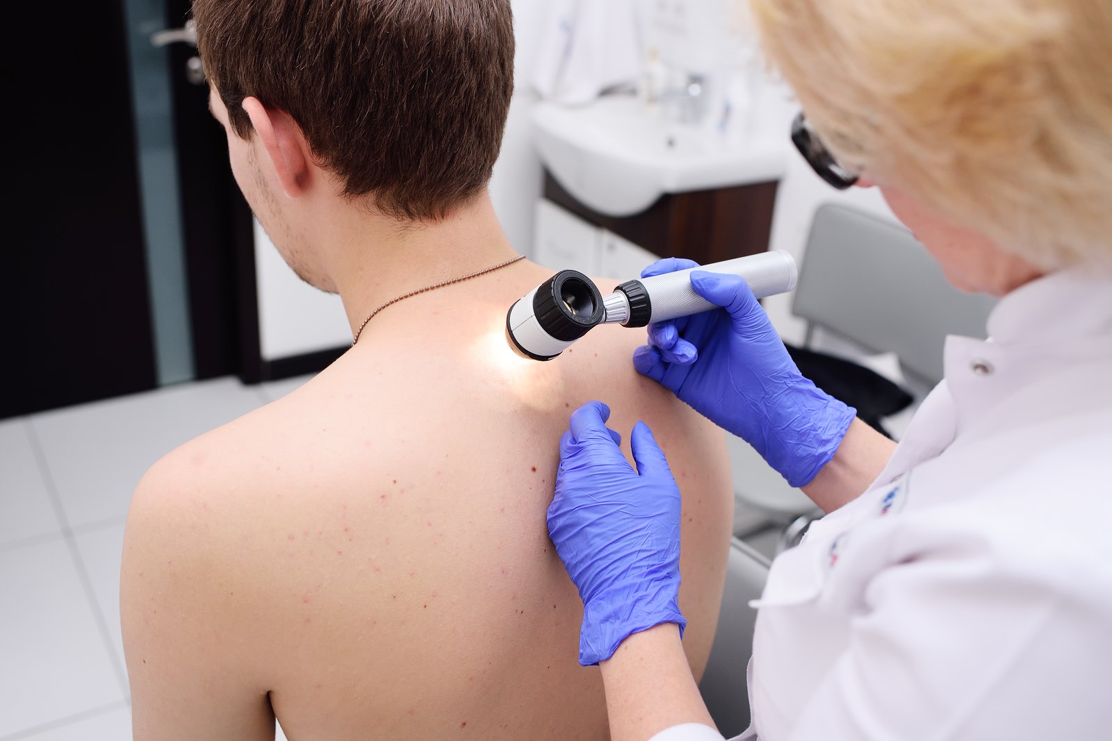 Dermatologist examining a young man's shoulder with a dermatoscope