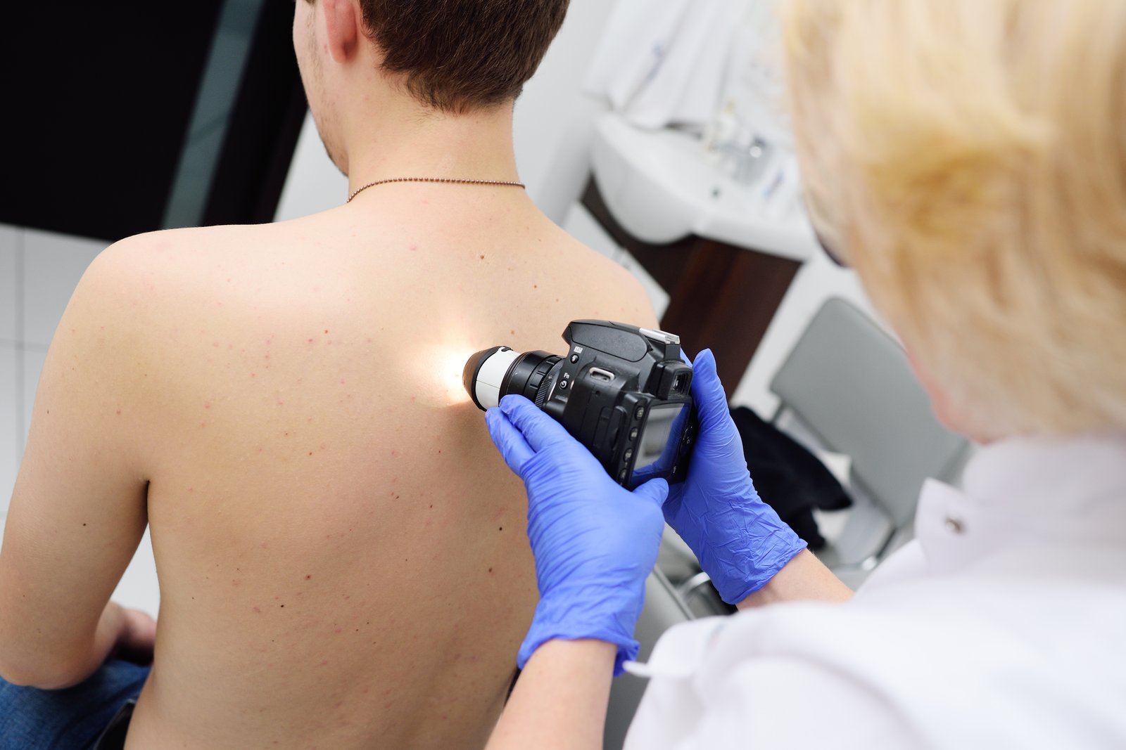 Clinician photographing moles on a patient's back with a camera