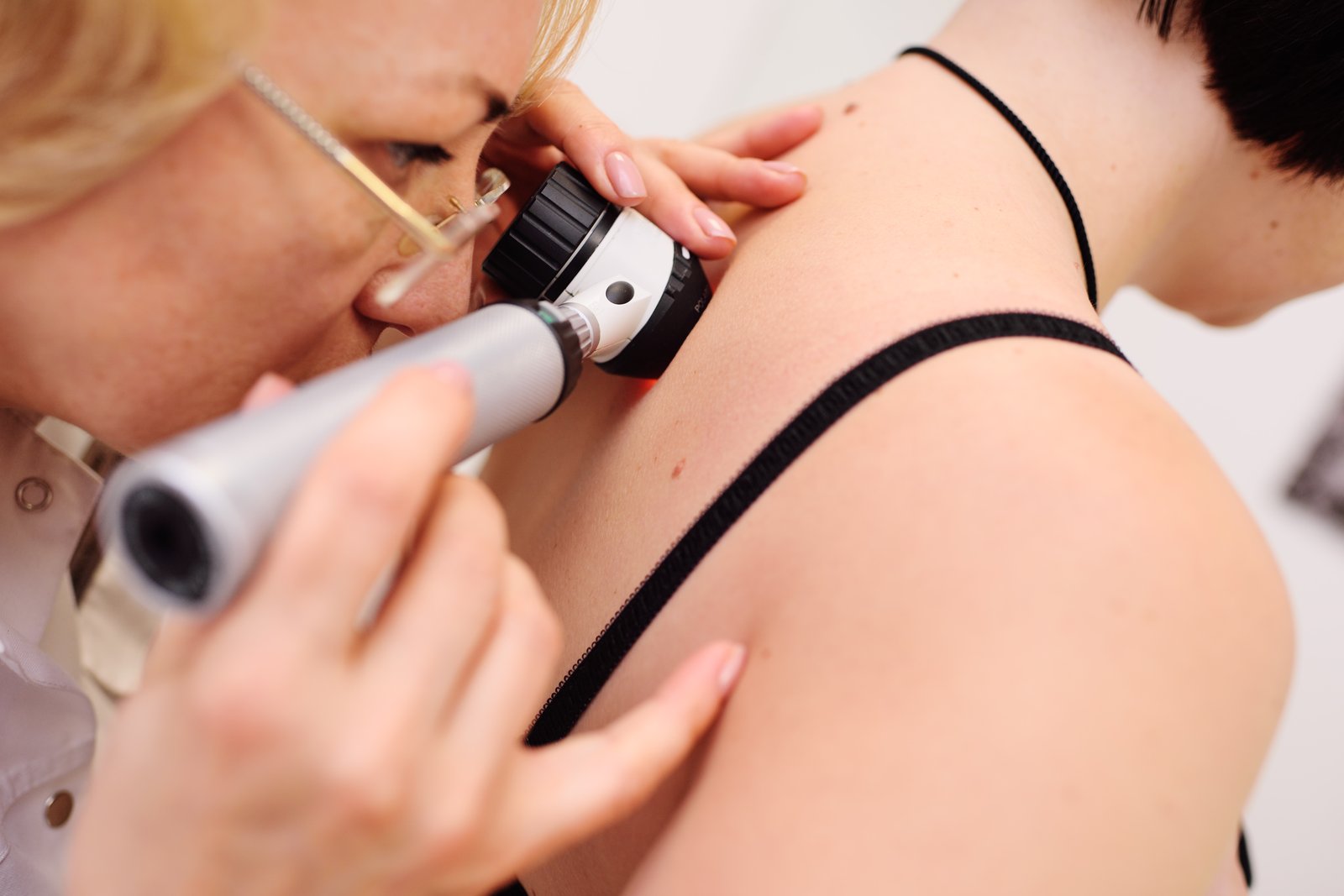 Dermatologist examining moles on a patient's shoulder with a dermatoscope