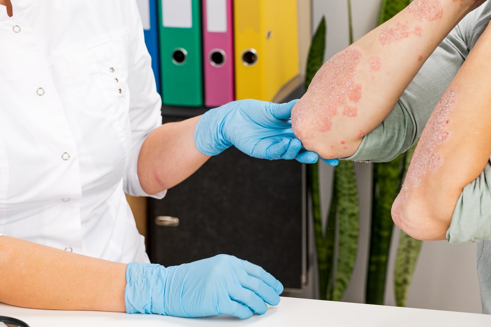 Dermatologist in gloves examining scaly skin on a patient's arms