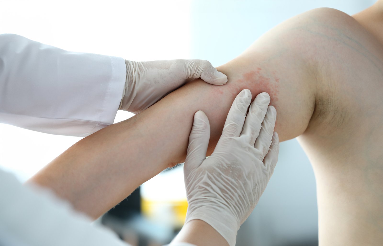 Gloved hands examining a reddened patch of skin on a patient's knee